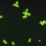 Streptococcus pneumoniae